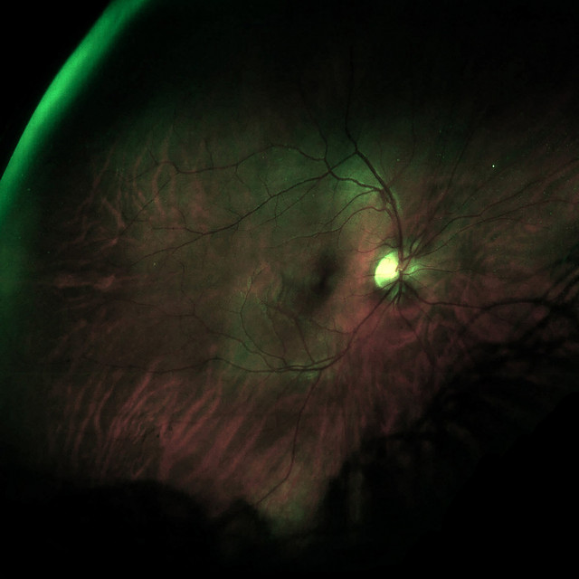 Cover image for playlist